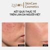 Tinh Chất Transparent Lab Oil Patrol Serum kiểm soát dầu, hỗ trợ làm mịn da 30ml