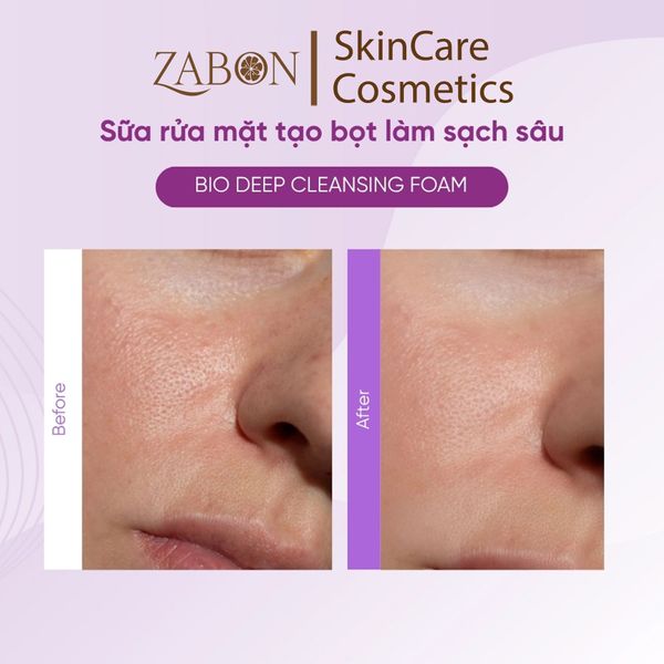 Sữa rửa mặt ABO Bio Deep Cleansing Foam giúp làm sạch sâu, cấp ẩm dịu da 150ml