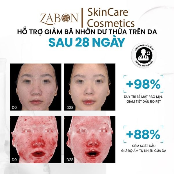 Serum MD CARE ZINC PHA Sebum Regulation Complex Kiểm Soát Dầu Sinh Học  30ml