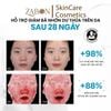 Serum MD CARE ZINC PHA Sebum Regulation Complex Kiểm Soát Dầu Sinh Học  30ml