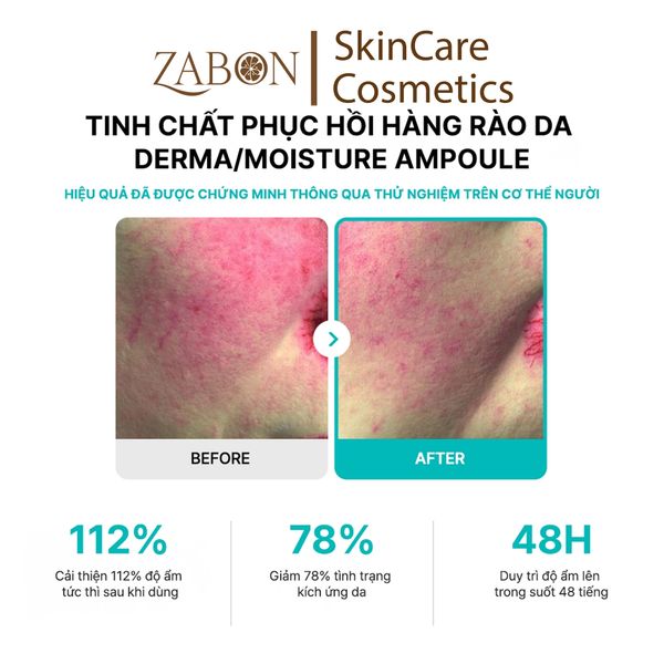 Tinh chất REJURAN MOISTURE TREATMENT AMPOULE dưỡng ẩm giúp làm dịu, hỗ trợ phục hồi 30ml