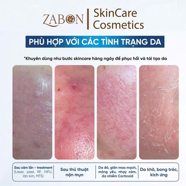 Mặt Nạ AHOHWA Vitamin K Calming Mask Cấp Ẩm Phục Hồi 23ml