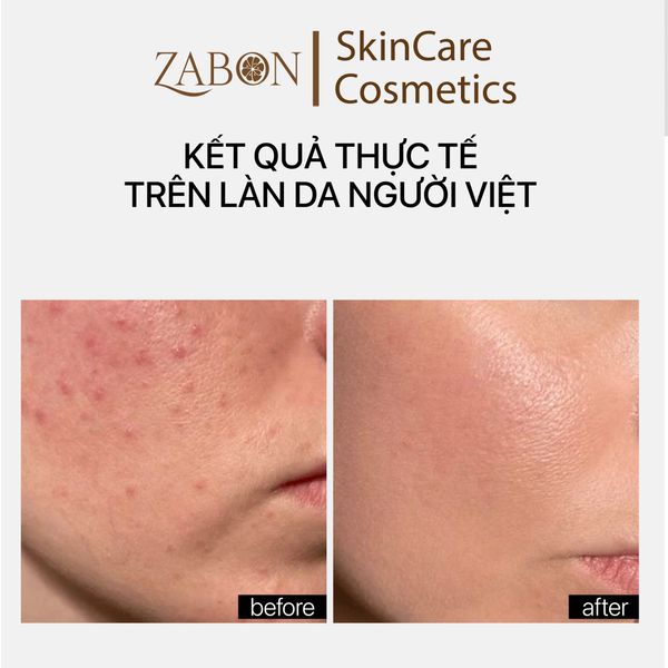 Kem TRANSPARENT CERAMIDE REPAIR MOISTURIZER phục hồi, dưỡng ẩm 30ml