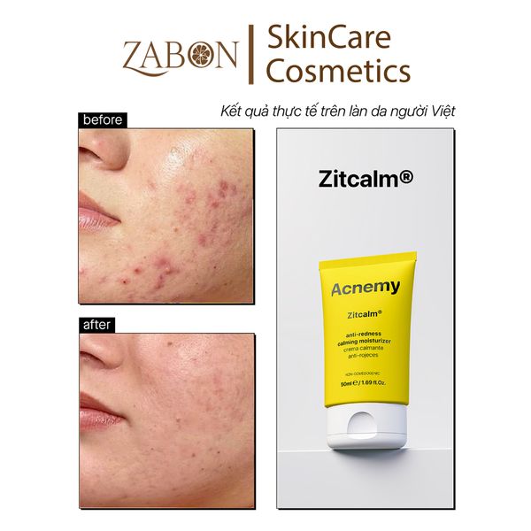 Kem ACNEMY CALMING MOISTURIZER dưỡng ẩm, làm dịu da 50ml