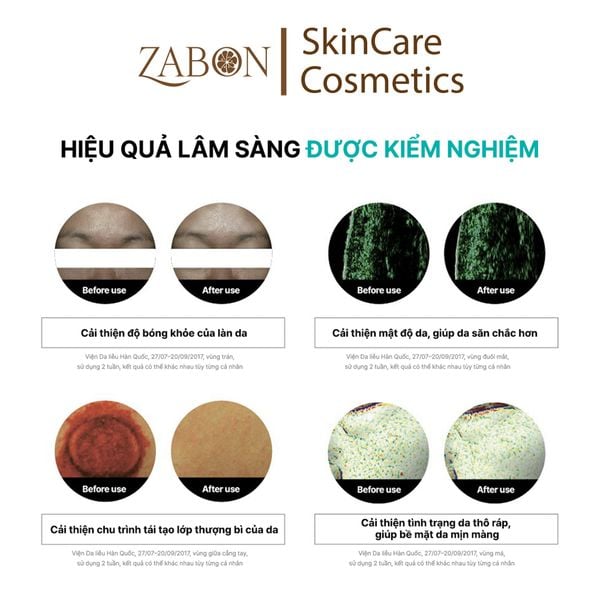 Tinh chất REJURAN Turnover Ampoule phục hồi tái tạo sáng da, căng bóng 30ml