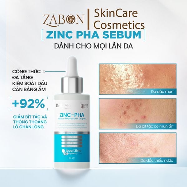 Serum MD CARE ZINC PHA Sebum Regulation Complex Kiểm Soát Dầu Sinh Học  30ml