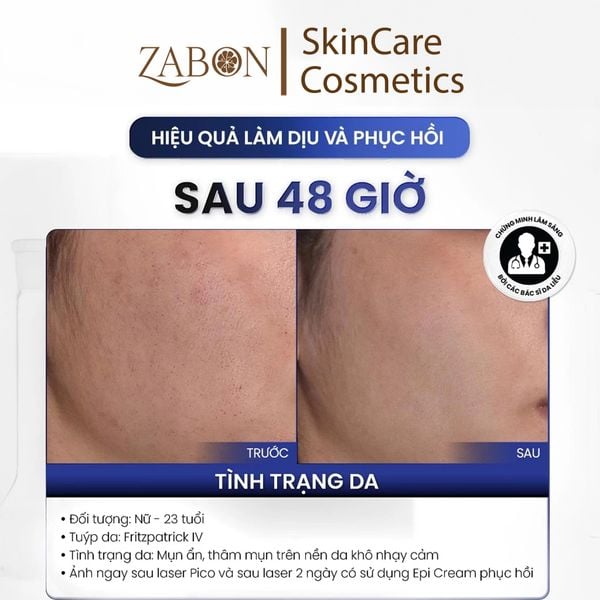 Kem dưỡng MD CARE Epi - ProCare Cream dưỡng ẩm phục hồi và cải thiện nếp nhăn 30ml