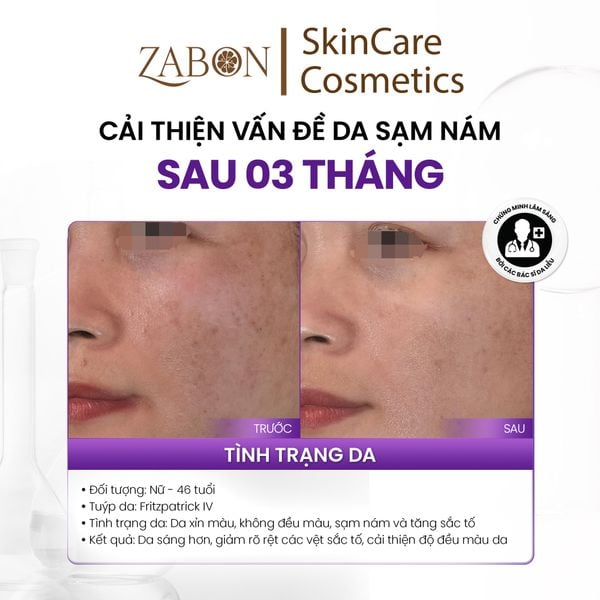 Kem dưỡng MD CARE A.R.T BRIGHTENING COMPLEX sáng da và cải thiện nếp nhăn 30ml