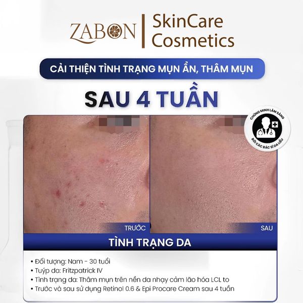 Kem dưỡng MD CARE PRO-RETINOL 0.6 làm sáng và cải thiện nếp nhăn 30ml