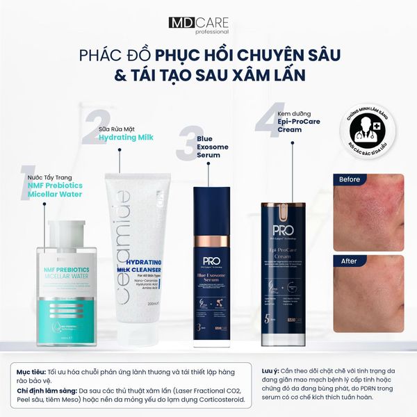 Serum MD CARE Blue Exosome phục hồi và trẻ hóa đa tằng 30ml