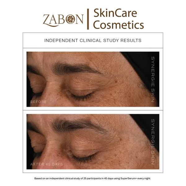 Serum Synergie Skin SuperSerum+ chống lão hóa tăng sinh collagen 30ml