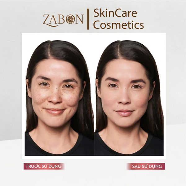 Tinh chất hỗ trợ ngăn ngừa lão hóa M. Asam Retinol Intense 1% Retinol Treatment 30ml