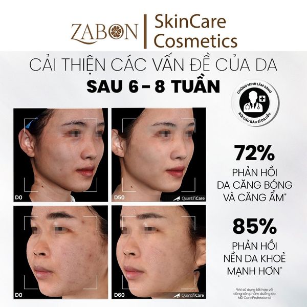 Sữa rửa mặt dịu nhẹ và cấp ẩm dành cho da nhạy cảm MD CARE Hydrating Milk Cleanser 200ml