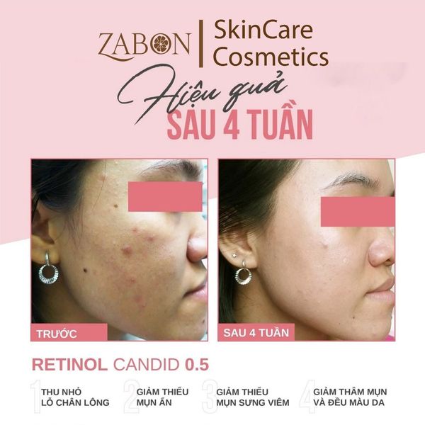 Hoạt chất Retinol 1.0% hỗ trợ cải thiện nền da CANDID 1.0% Retinol Treatment 30ml