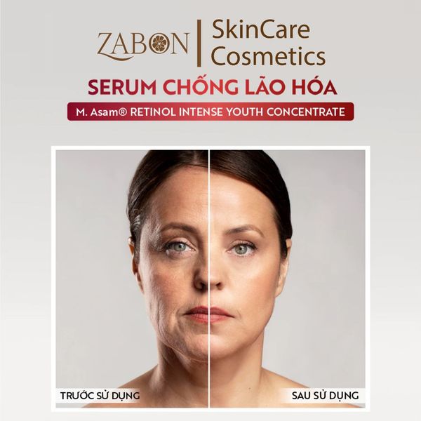 Serum Hỗ Trợ Ngăn Ngừa Lão Hóa M. Asam Retinol Intense Youth Concentrate 30ml