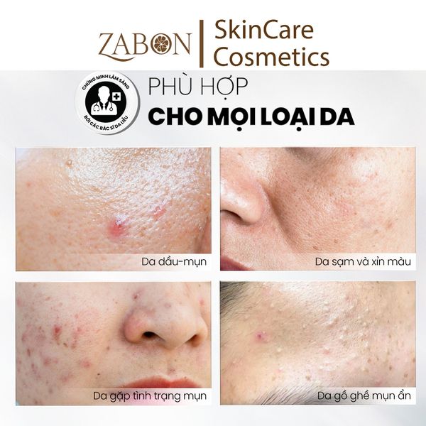 Sữa rửa mặt BHA dạng bọt dành cho da dầu mụn nhạy cảm MD CARE Salicylic Facial Foaming Cleanser 150ml