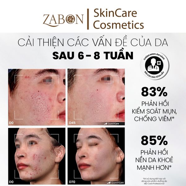 Sữa rửa mặt BHA dạng bọt dành cho da dầu mụn nhạy cảm MD CARE Salicylic Facial Foaming Cleanser 150ml
