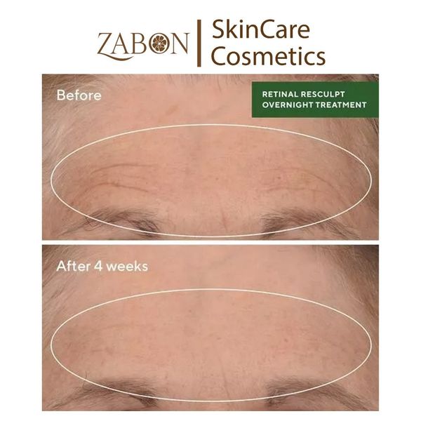 Tinh chất Retinal giúp cải thiện độ đàn hồi cho da Murad Retinal ReSculpt Overnight Treatment 30ml