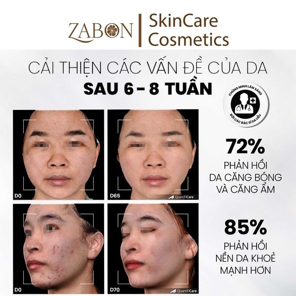Tẩy tế bào chết làm sáng, mờ thâm và đều màu da MD CARE Glow Exfo 10ml (mini size)