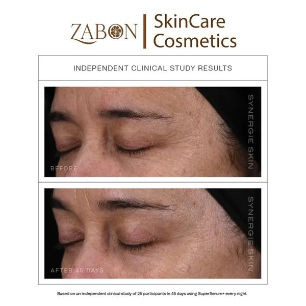 Serum Synergie Skin SuperSerum+ chống lão hóa tăng sinh collagen 30ml