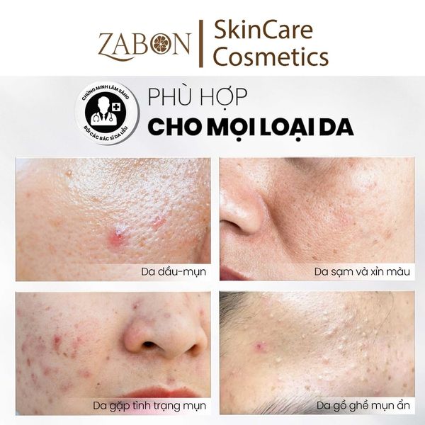 Tẩy tế bào chết kiểm soát mụn, giảm viêm và giảm tiết dầu MD CARE AntiAc Exfo 10ml (mini size)