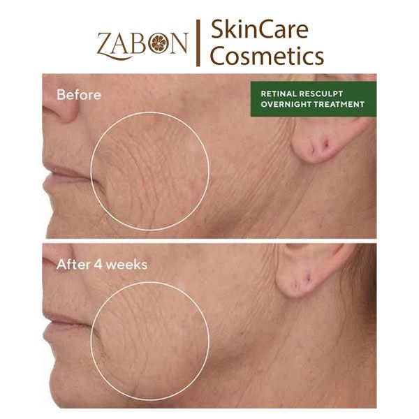 Tinh chất Retinal giúp cải thiện độ đàn hồi cho da Murad Retinal ReSculpt Overnight Treatment 30ml