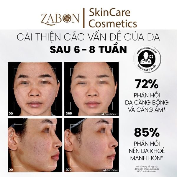 Sữa rửa mặt dạng gel sạch sâu và tẩy tế bào chết nhẹ nhàng MD CARE Mandelic Acid 5% Gel Cleanser 30ml