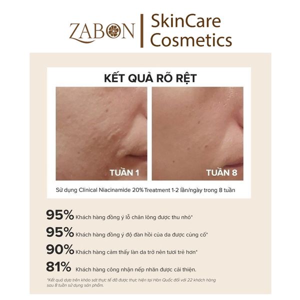 Tinh chất se khít lỗ chân lông và làm mờ thâm mụn Paula's Choice Niacinamide 20% Treatment 20ml