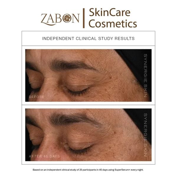 Serum Synergie Skin SuperSerum+ chống lão hóa tăng sinh collagen 10ml