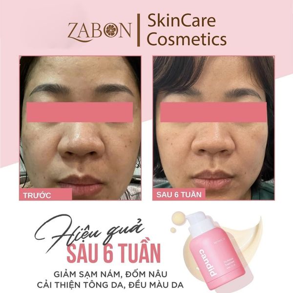 Hoạt chất Retinol 1.0% hỗ trợ cải thiện nền da CANDID 1.0% Retinol Treatment 30ml