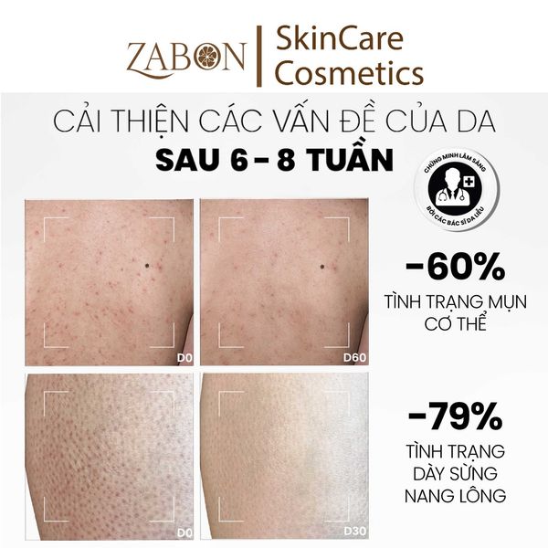 Sữa tắm giảm mụn & Tẩy tế bào chết MD care AHAs & BHA Exfoliating Body Wash 200ml