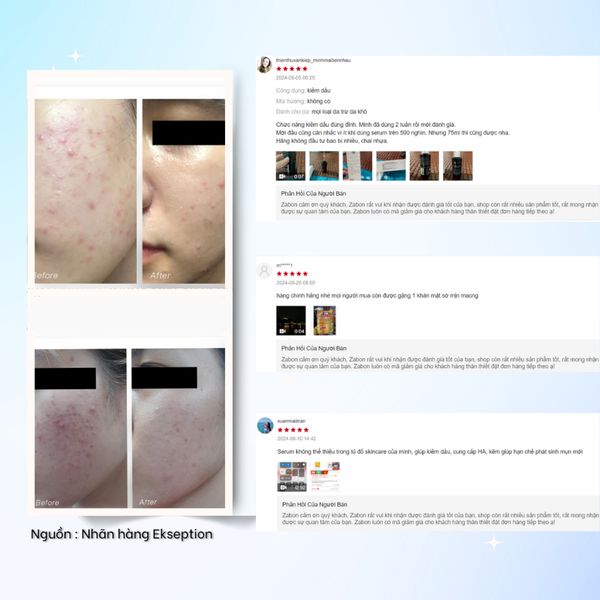 Serum Ekseption Hyaluronic ZnPCA dưỡng ẩm, giúp kiềm dầu, giảm mụn 75ml