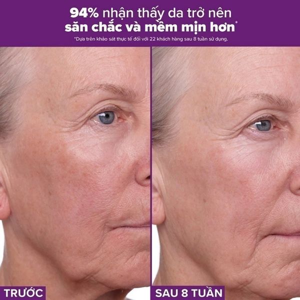 Tinh chất chống lão hóa giúp mờ vết thâm và nếp nhăn Paula's choice Clinical 0.3% Retinol + 2% Bakuchiol Treatment 30ml