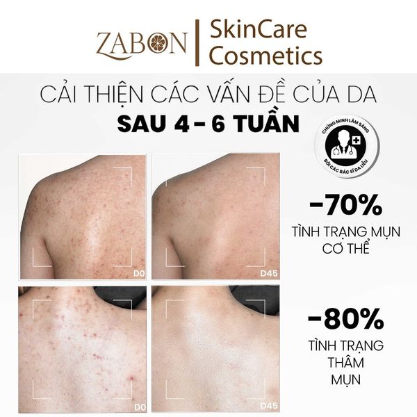 Xịt tẩy tế bào chết toàn thân MD Care Exfoliating Body Spray 100ml
