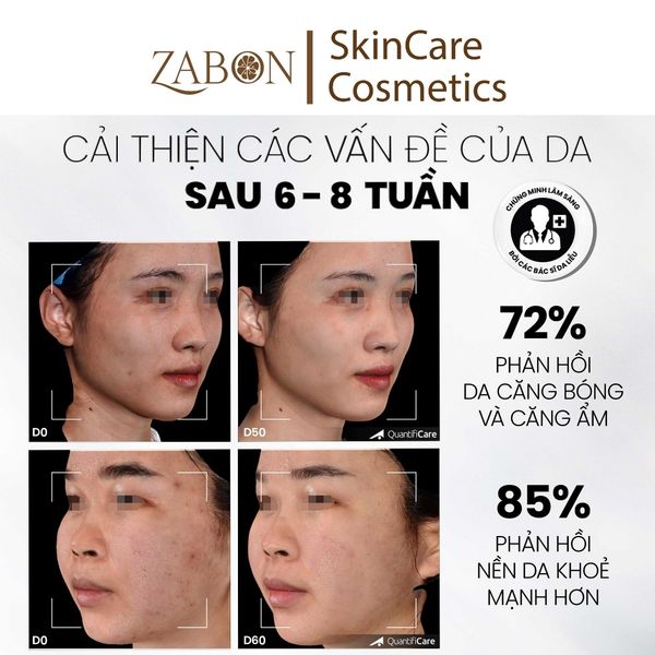 Tẩy tế bào chết căng bóng, cấp ẩm và làm sáng da MD CARE Mande Exfo 10ml (mini size)