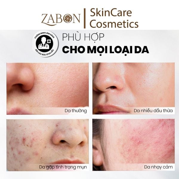 Sữa rửa mặt dạng gel sạch sâu và tẩy tế bào chết nhẹ nhàng MD CARE Mandelic Acid 5% Gel Cleanser 30ml