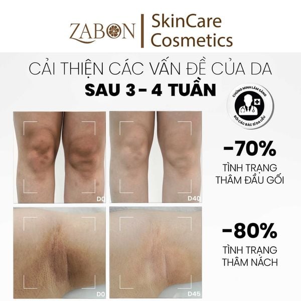 Sữa dưỡng thể sáng da mờ thâm MD care Brightening Booster Body Lotion 200ml