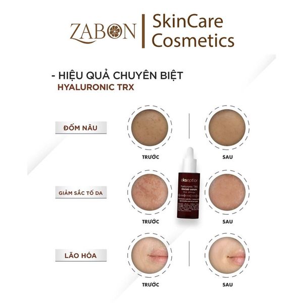 SERUM Cho da sạm nám EKSEPTION HYALURONIC TRX MIXLAB 75ML