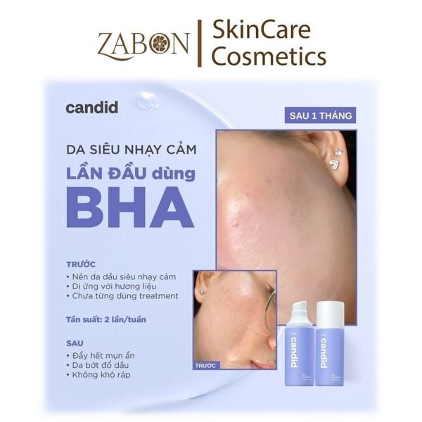 Bộ đôi hỗ trợ cải thiện da toàn diện Candid Retinol 1.0% 30ml & Hoạt chất BHA 100ml