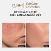 [Mini] Kem dưỡng TRANSPARENT LAB NIACINAMIDE GLOW CREAM dưỡng sáng da 15ml