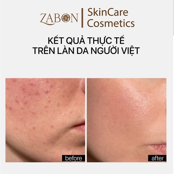 [Mini] Kem dưỡng TRANSPARENT CERAMIDE REPAIR MOISTURIZER phục hồi, dưỡng ẩm da 10ml