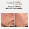 [Mini] Kem dưỡng TRANSPARENT CERAMIDE REPAIR MOISTURIZER phục hồi, dưỡng ẩm da 10ml