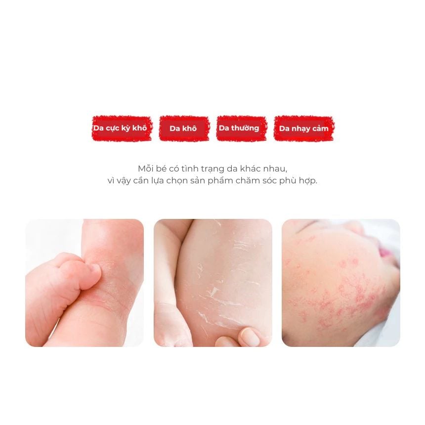  Sữa Dưỡng Thể Hằng Ngày Milk Baobab Baby Moisture Lotion 