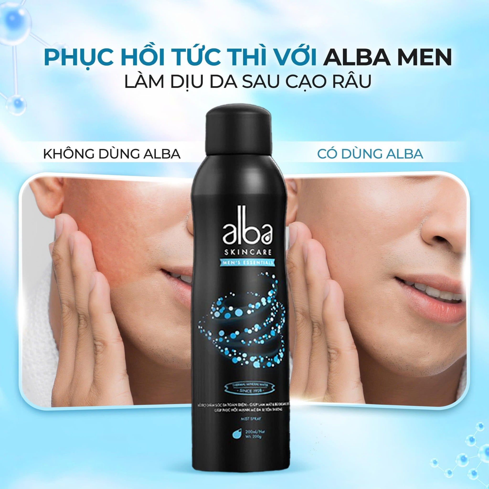  [MEN] Xịt Khoáng Cấp Ẩm, Kềm Dầu & Giảm Mụn Cho Nam Alba Skincare Men 200ml 
