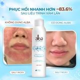  [LADY] Xịt Khoáng Cấp Ẩm & Phục Hồi Da Cho Nữ 300ml Alba Skincare - Nước Khoáng Thanh Tân Giàu Silic - Chống Lão Hóa & Tăng Độ Đàn Hồi 