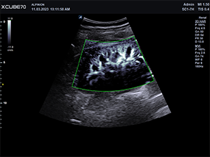  Máy siêu âm X-CUBE 70 