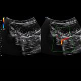  Máy siêu âm X-CUBE 60 
