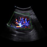  Máy siêu âm X-CUBE 60 