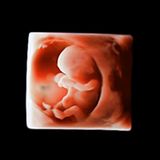  Máy siêu âm X-CUBE 90 