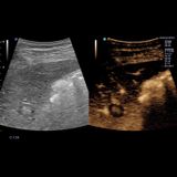  Máy siêu âm X-CUBE 90 